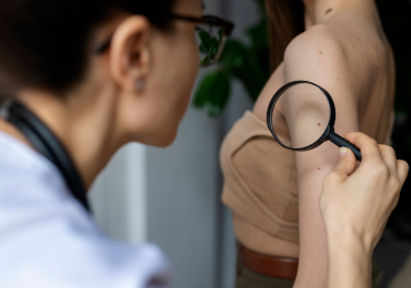 Аллергические дерматиты и сухость кожи в осенний период.