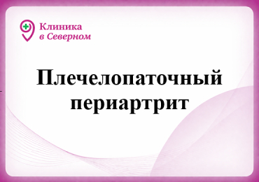 Плечелопаточный периартрит