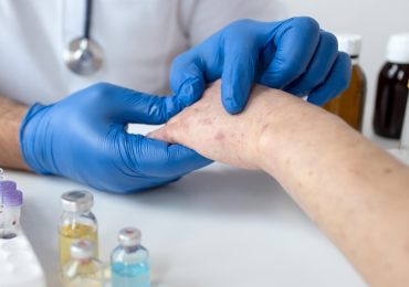 Первичный прием дерматовенеролога: когда важно не откладывать 