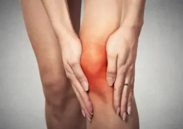 Гонартроз - деформирующий артроз коленного сустава