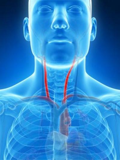 Как проходит операция при патологической извитости сонной артерии