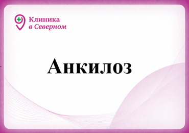 Анкилоз 