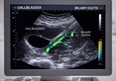 Билиарный сладж. Что это?