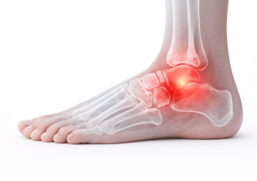 Болезнь Келлера 