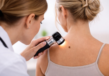 Что такое дерматоскопия и для чего она нужна? 