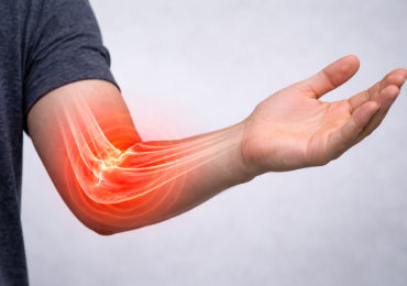 Эпикондлит 