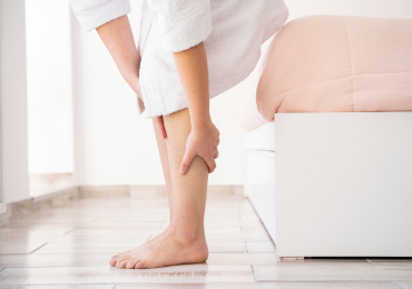 Варикоз: не просто косметический дефект, а серьезная болезнь. Когда пора к флебологу?