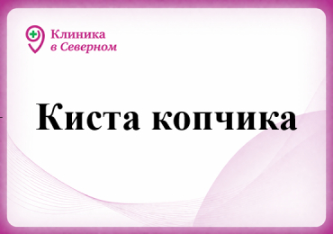 Киста копчика