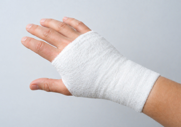 Перелом пястных костей