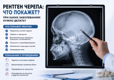 Рентген черепа: что покажет? при каких заболеваниях нужно делать?