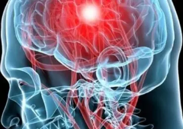 Энцефалопатия головного мозга