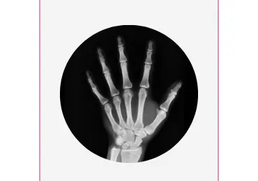 Рентгенография не только при травмах. В каких ситуациях и когда применяется рентгенография?