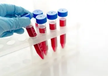 Биохимический анализ крови: что показывает и как подготовиться