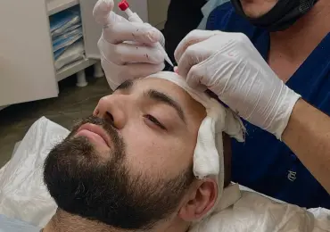 Пересадка волос: как проходит операция по дням - честный разбор без прикрас Пересадка волос: как проходит операция по дням - честный разбор без прикрас