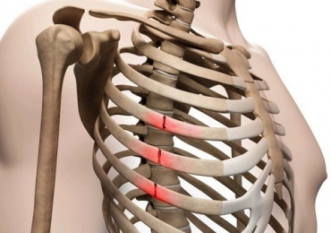 Травмы груди и способы их лечения – Кладовой Здоровья