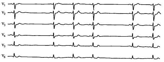 Qrs деформирован что это значит. %D1%81%D0%B8%D0%BD(4). Qrs деформирован что это значит фото. Qrs деформирован что это значит-%D1%81%D0%B8%D0%BD(4). картинка Qrs деформирован что это значит. картинка %D1%81%D0%B8%D0%BD(4)