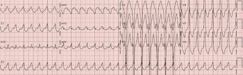 Qrs деформирован что это значит. %D1%81%D0%B8%D0%BD(9). Qrs деформирован что это значит фото. Qrs деформирован что это значит-%D1%81%D0%B8%D0%BD(9). картинка Qrs деформирован что это значит. картинка %D1%81%D0%B8%D0%BD(9)