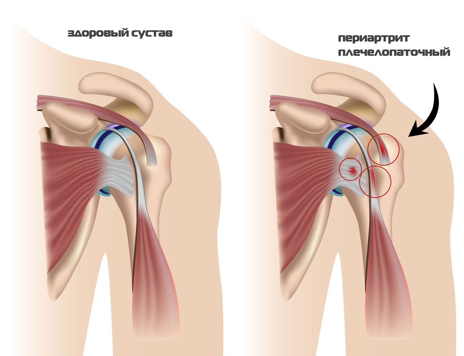 ПЛЕЧЕВОЙ СУСТАВ, собственные связки. Иннервация кровоснабжение. МЫШЦЫ