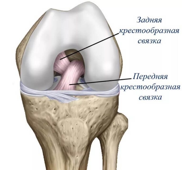 Артроскопическая операция ПКС коленного сустава в «МедикаМенте»